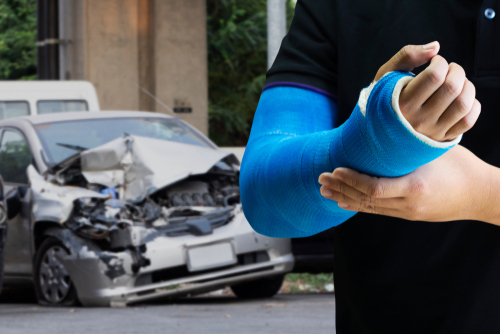 car injuries
