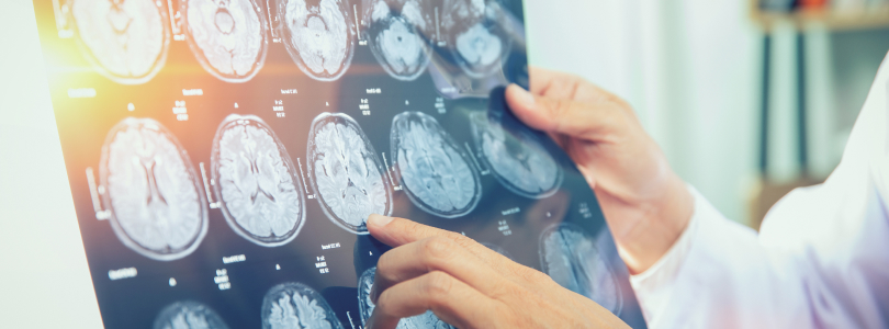 traumatic brain injuries